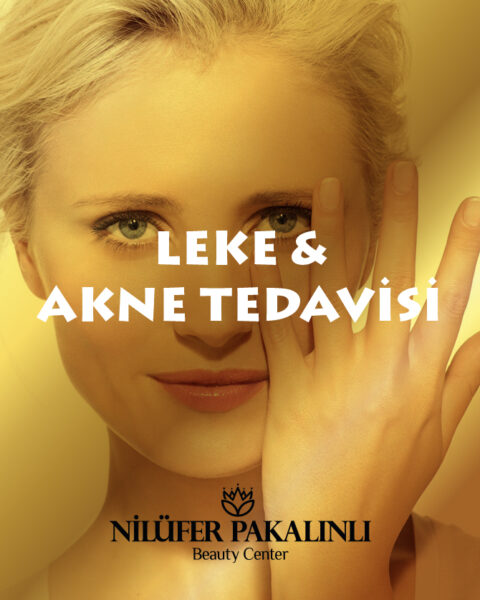Leke ve Akne Tedavisi